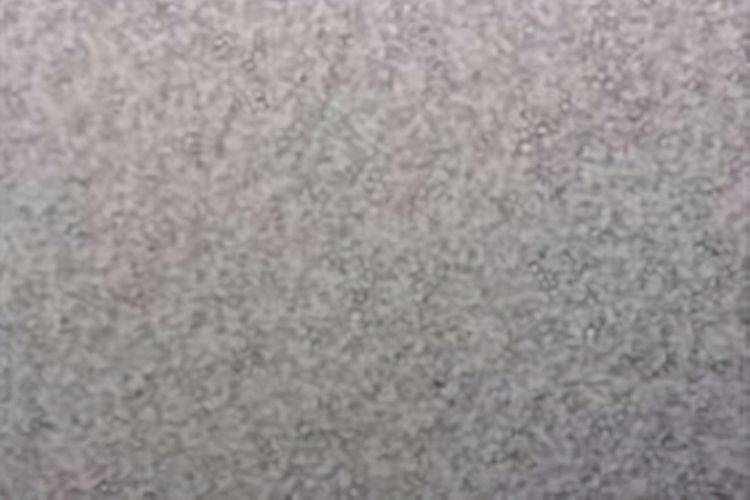 母乳本来的面目：显微镜下千倍放大，让人感叹母爱的伟大