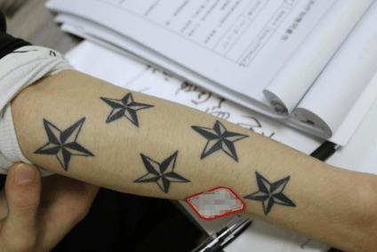 洗纹身收费价格表