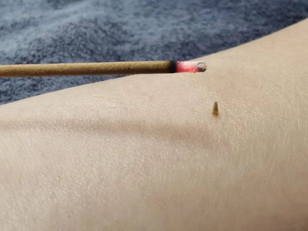 醒来“天塌了”！深圳一女子眼睛闭不上、嘴巴漏水！这些错误很多人会犯