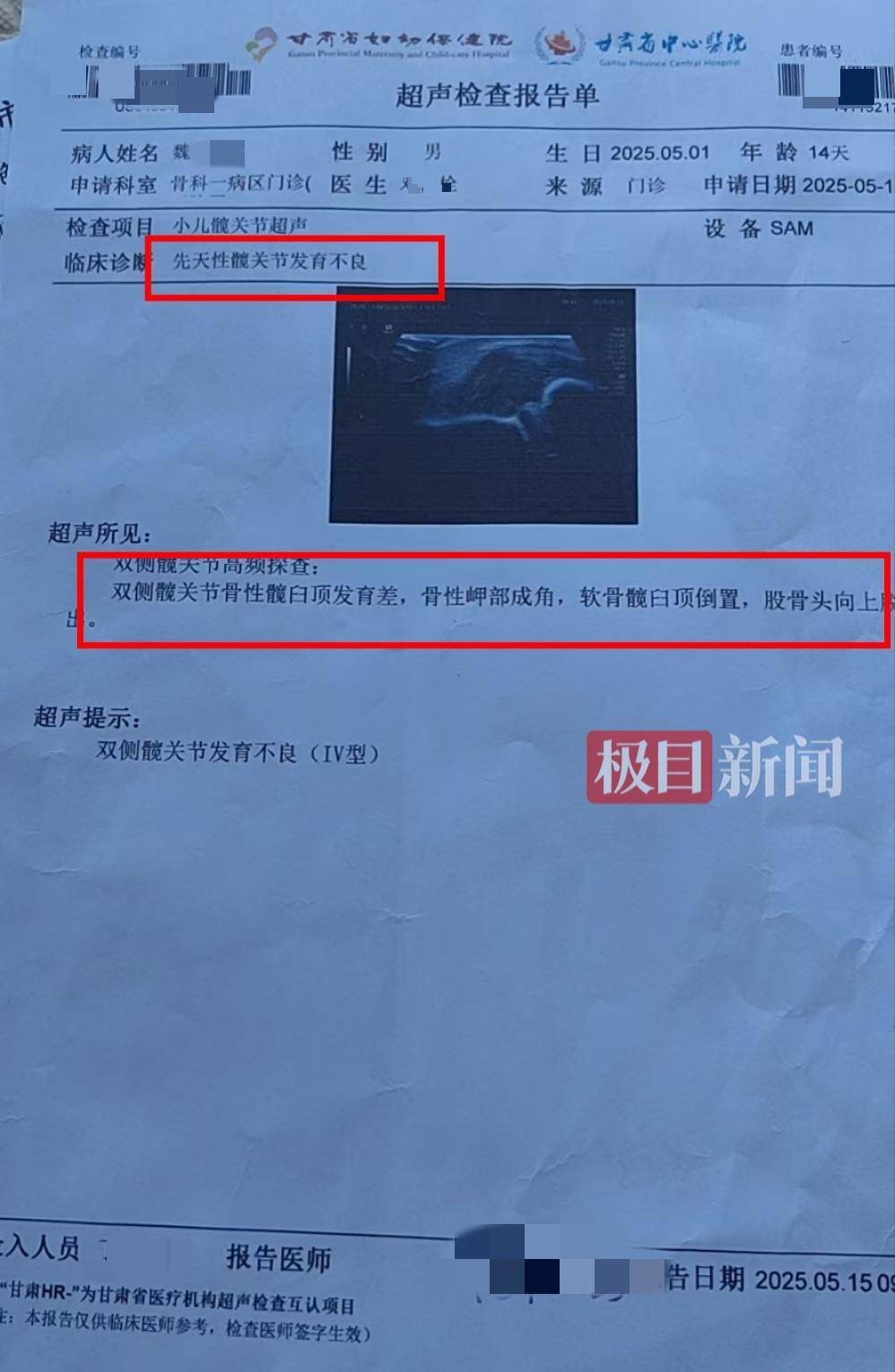 二胎出生查出先天性病症或落下残疾，残疾父母称医院产检漏检、未尽告知义务，医院及医调委回应