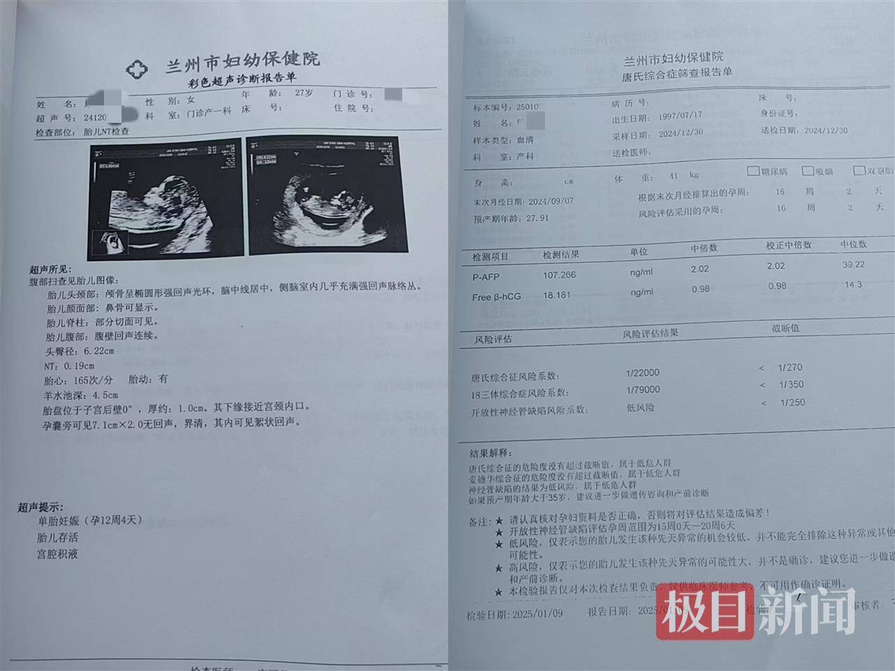 二胎出生查出先天性病症或落下残疾，残疾父母称医院产检漏检、未尽告知义务，医院及医调委回应