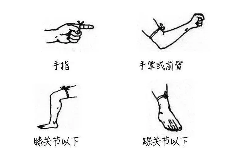 游客三亚疑被蛇咬身亡，当地曾公布3家医院有抗蛇毒血清