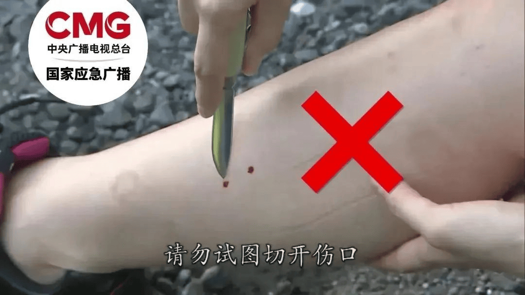 游客三亚疑被蛇咬身亡，当地曾公布3家医院有抗蛇毒血清