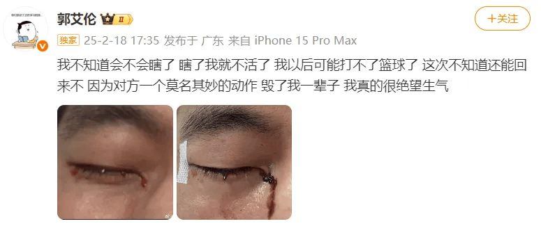 31岁郭艾伦直言想回国家队，但应该没什么机会了，此前眼睛被队友误伤，缝了40多针