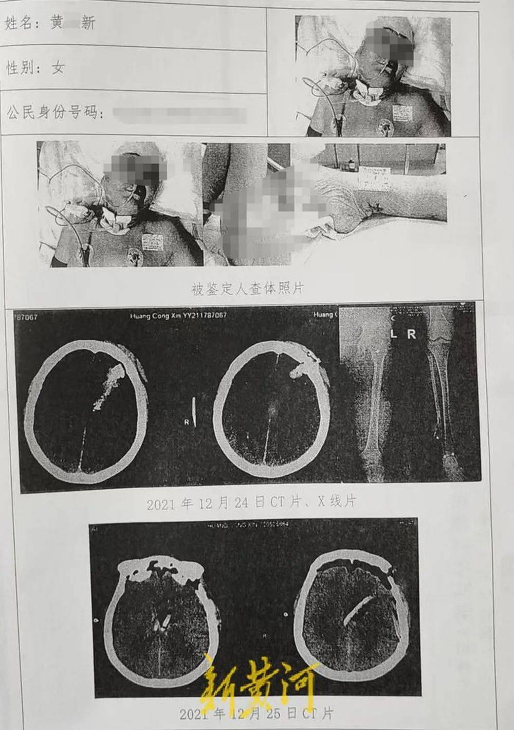 六旬老人遭狩猎者枪击致重伤，开枪者两次逃离现场，事发4小时后冒充“好心人”施救，家属：耽误了最佳救治时间