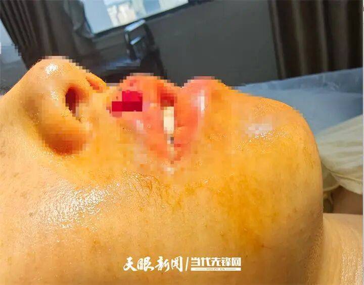 女子上门代喂被100多斤阿拉斯加犬咬伤毁容，牙槽骨和牙齿都被撕咬脱落，狗主人却称→