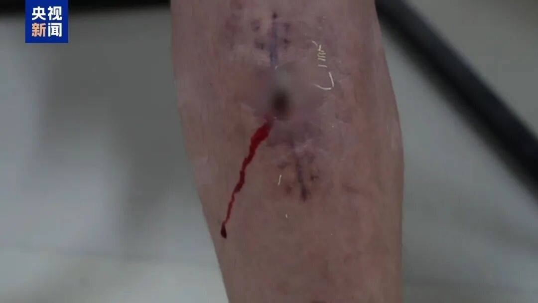 一个中国人卖30多万，接班人和金主结拜杀人祭天……缅北果敢魏家犯罪集团专案细节曝光